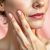 Objawy skórne menopauzy – co warto wiedzieć o zmianach?